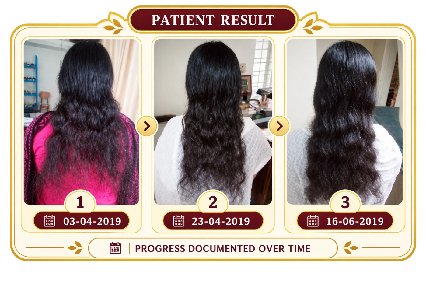 Hair and scalp progress documented during treatment
