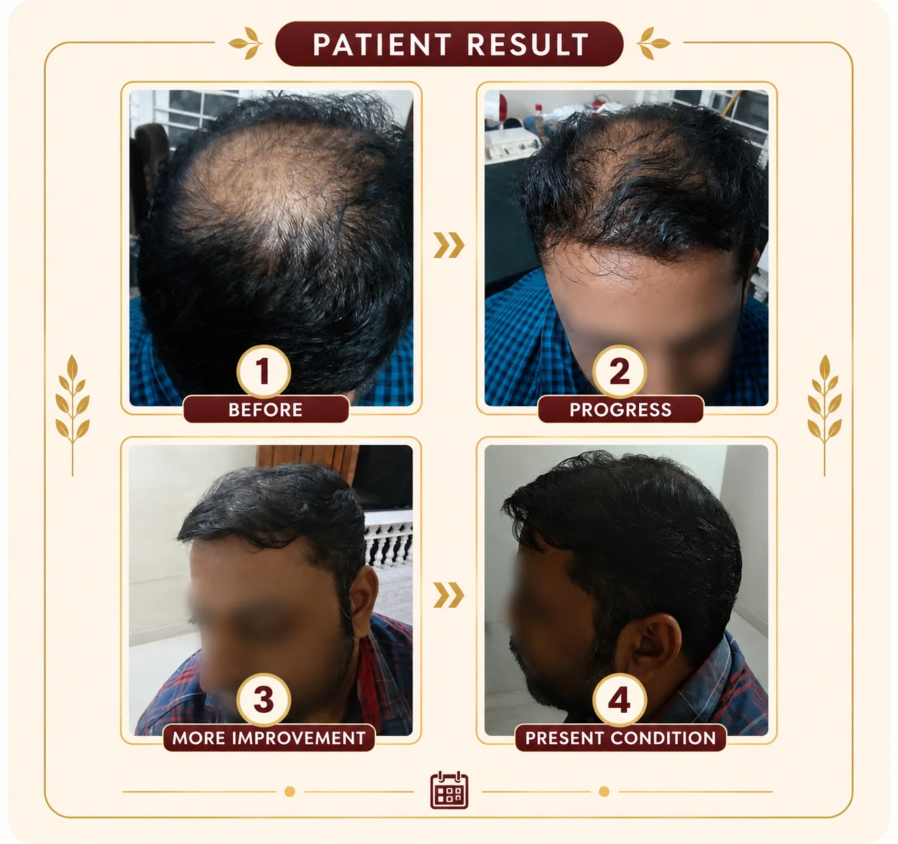 Patient hair progress documented over multiple visits