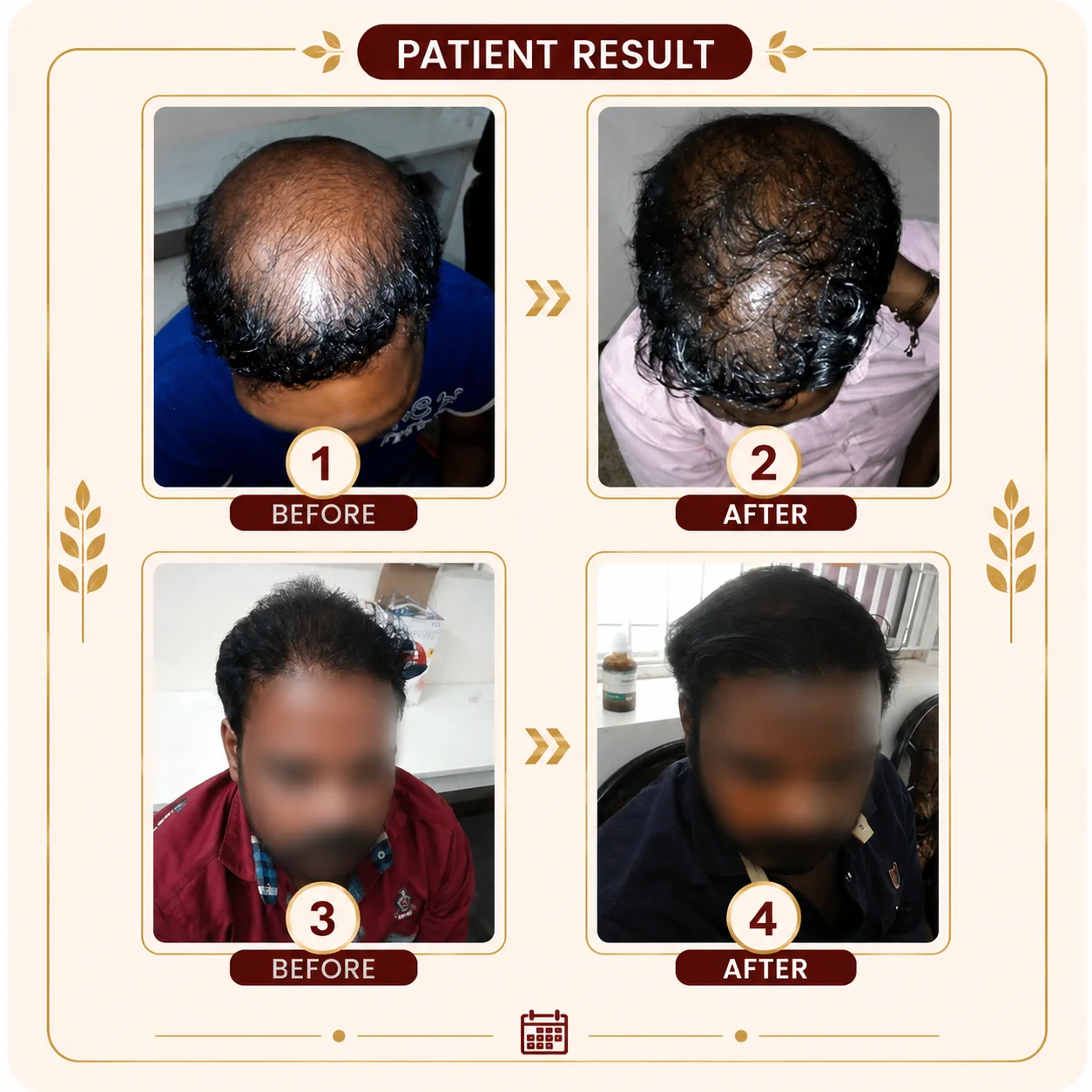 Patient hair progress before and after