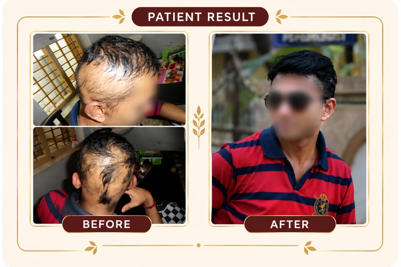 Hair and scalp progress documented during treatment