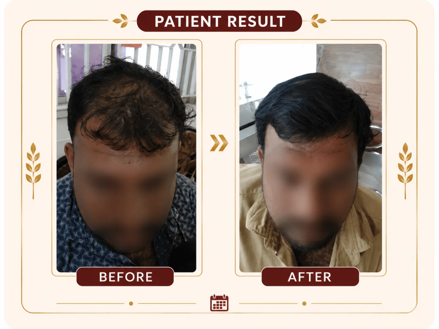 Patient hair progress documented over multiple visits