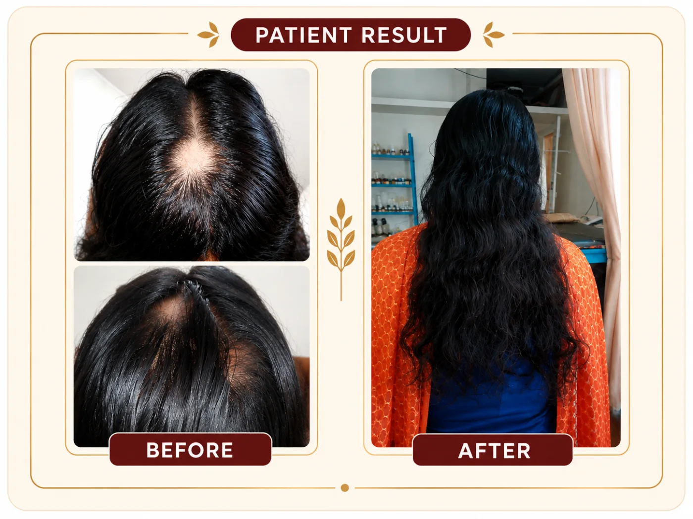 Patient hair progress documented over multiple visits